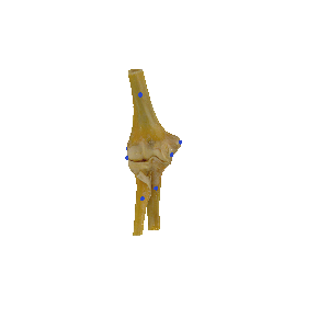 图 1-44 肘关节（关节囊）