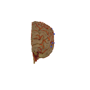 大脑半球的动脉