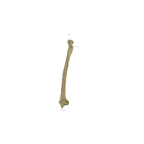 图 1-16 桡骨和尺骨（示桡骨）