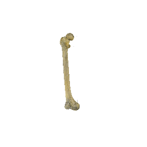 图 1-20 股骨