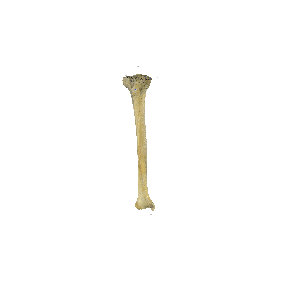 图 1-22 胫骨和腓骨（示胫骨）