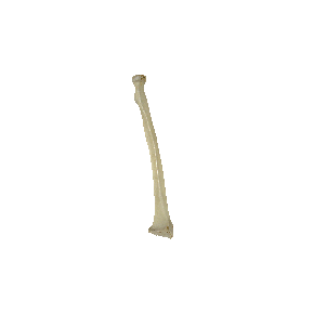 图2-17 桡骨和尺骨（示桡骨）